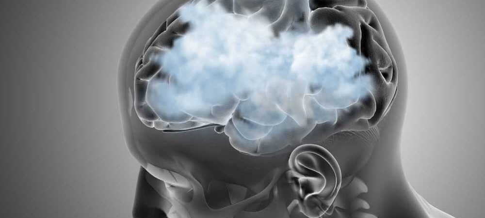Cara Mengatasi Brain Fog Saat Bangun Tidur agar Fokus Seharian